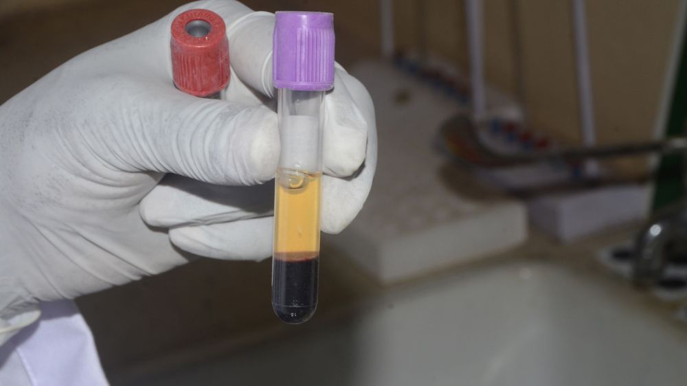 ������� � �������� �� ���������������� �������